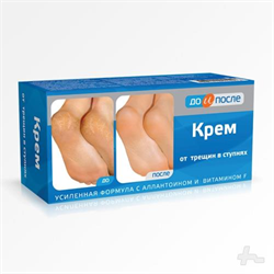до и после крем для ног 150мл п/трещин в ступнях фото