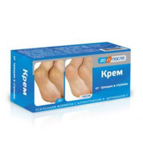 до и после крем от трещин в ступнях 50 мл фото