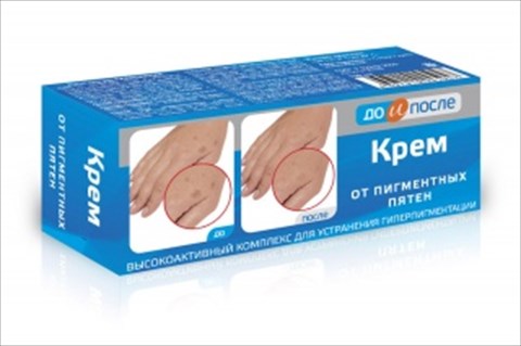 до и после крем от пигментных пятен 150 мл фото
