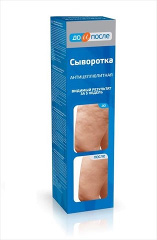 до и после сыворотка антицеллюлитная 130 мл фото