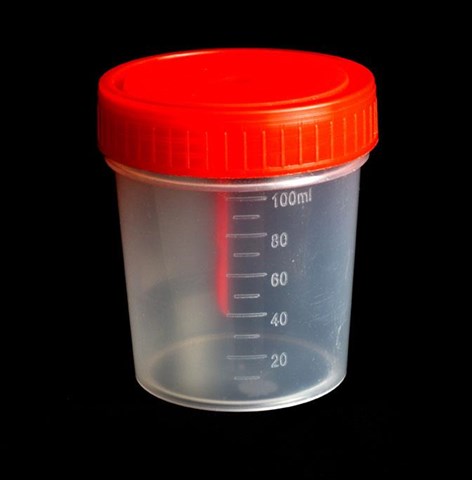 контейнер для сбора биоматериалов 100мл стерил фото