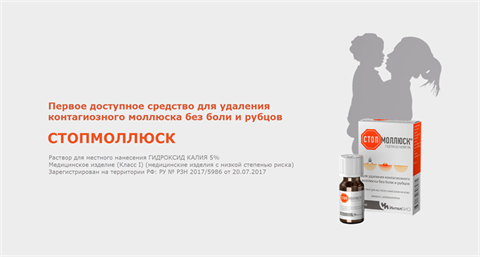 стопмоллюкс р-р для местн примен 5% 5мл для удал контагиозного моллюска фото