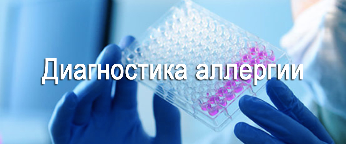 диагностика аллергии 
