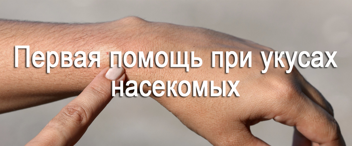 первая помощь при укусах насекомых