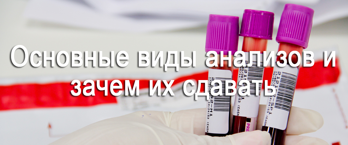 основные виды анализов и зачем их сдавать