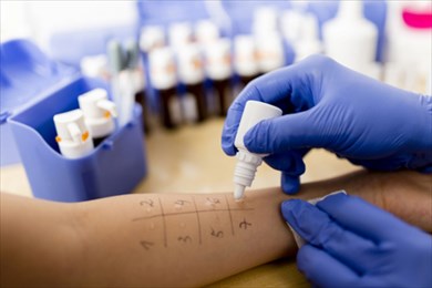 диагностика аллергии 