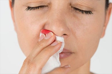 как остановить кровь из носа