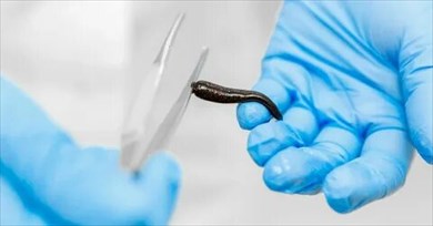 медицинские пиявки в народной аптеке