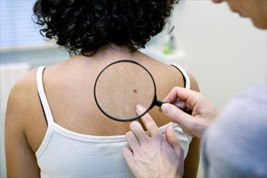 опасны ли родинки?