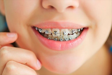 зачем исправлять неправильный прикус