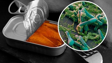 ботулизм , симптомы, первые признаки, лечение и профилактика.